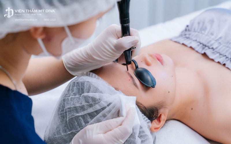 Nốt ruồi ở khuỷu tay có ý nghĩa gì? Tướng số Tốt hay xấu? 6