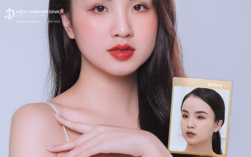 Bạn nên cân nhắc giữa chi phí khử thâm môi và chất lượng thực tế