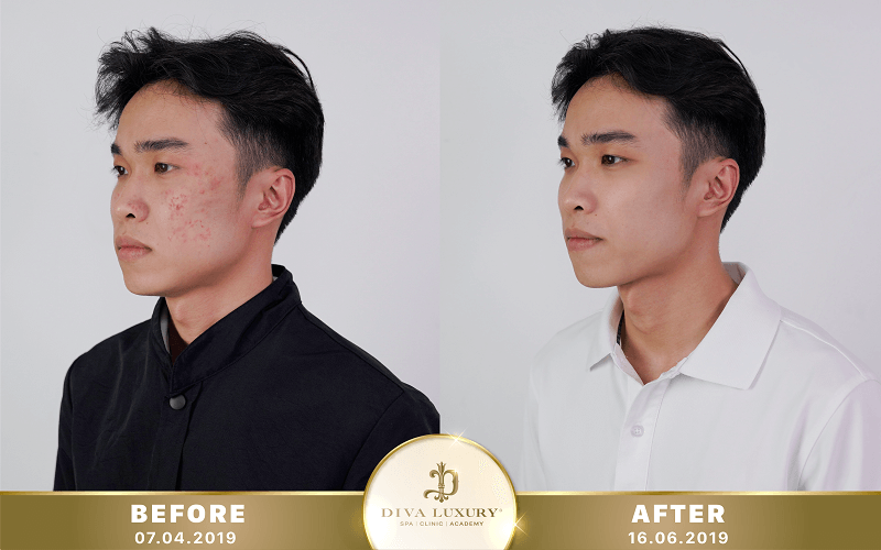 tr-mun-hoc-mon tri-mun-hoc-mon-15