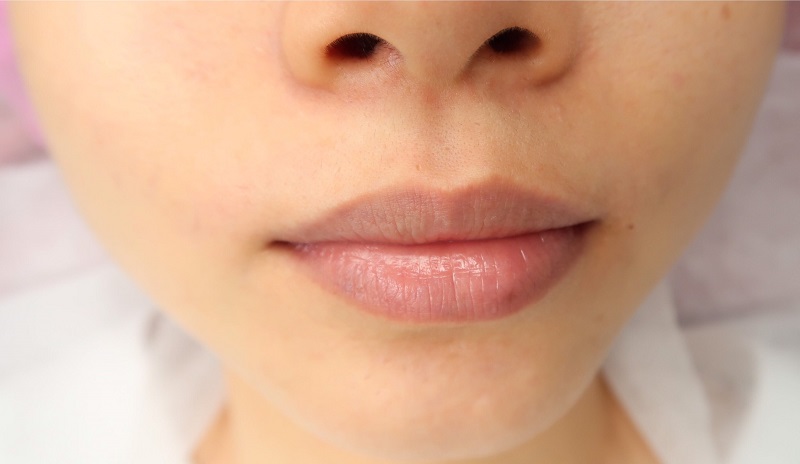 dam-moi-o-hong-ngu-1