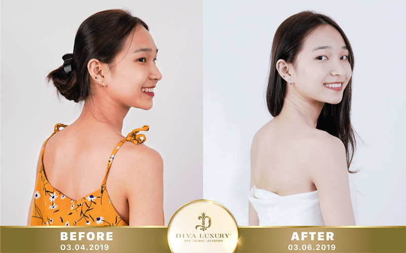 chuong-trinh-noel-vien-tham-my-diva chuong-trinh-noel-vien-tham-my-diva