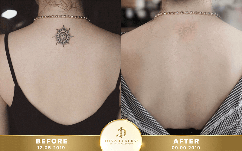 chuong-trinh-noel-vien-tham-my-diva chuong-trinh-noel-vien-tham-my-diva