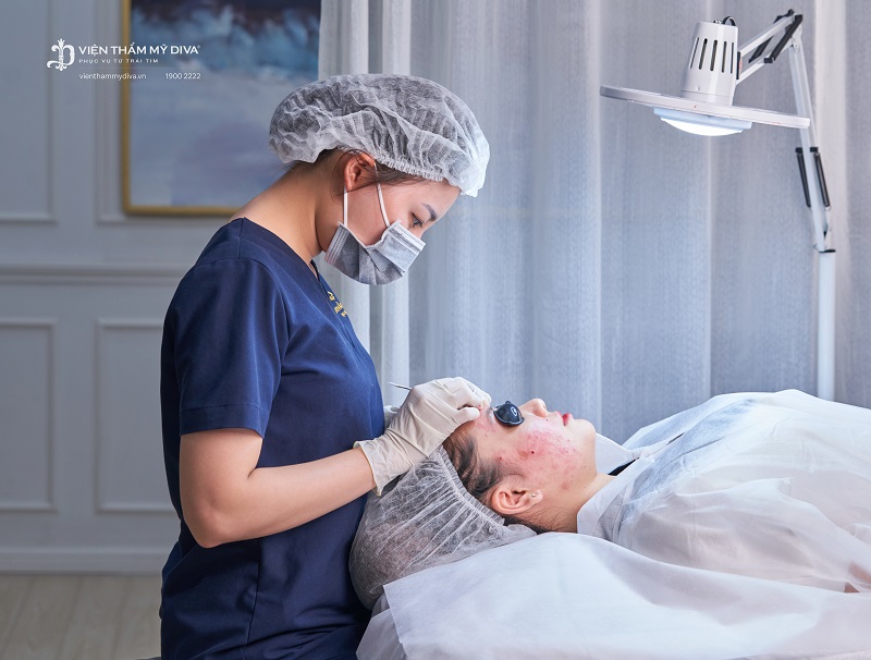 trị mụn ở rạch giá