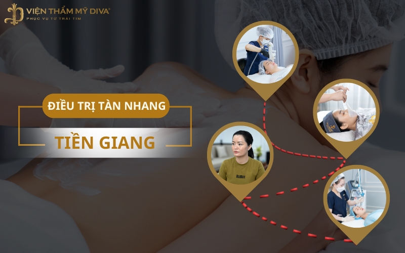 Gợi Ý Top 7 Địa Chỉ Điều Trị Tàn Nhang Tại Tiền Giang