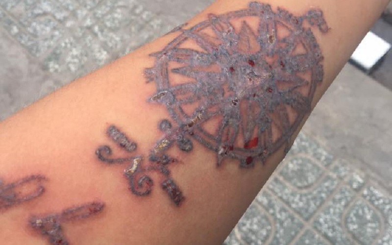 xoa-xam-da-nang xoa-xam-da-nang-1