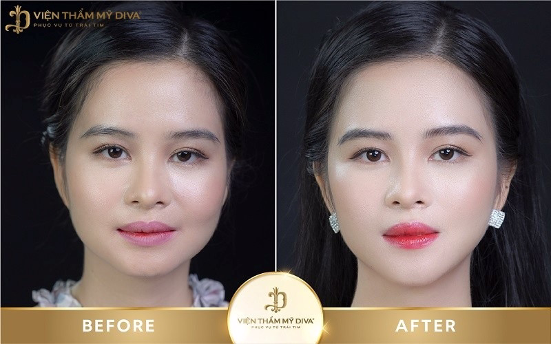 Hình ảnh của khách hàng trước và sau khi phun môi tế bào gốc