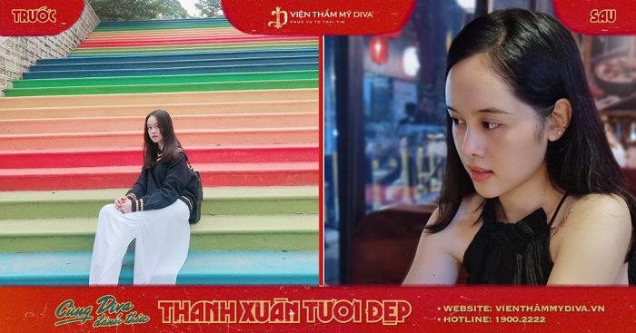 Giải Khuyến khích - 5