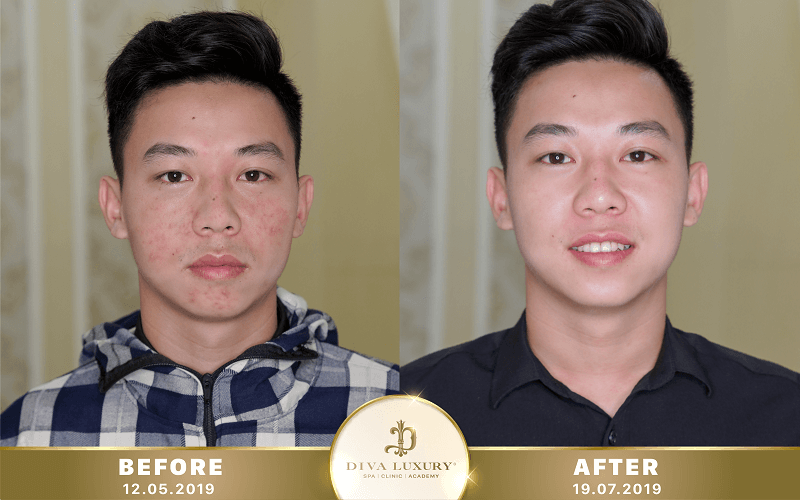 tri-mun-hoc-mon tri-mun-hoc-mon-14