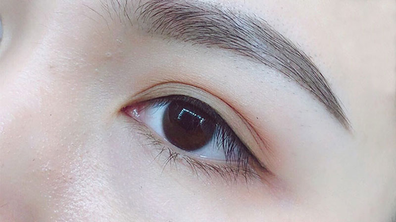 mo-goc-mat-o-can-tho mo-goc-mat-o-can-tho-9