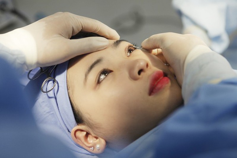 mo-goc-mat-o-dau-dep-3