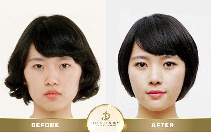 mo-goc-mat-o-dau-dep-7