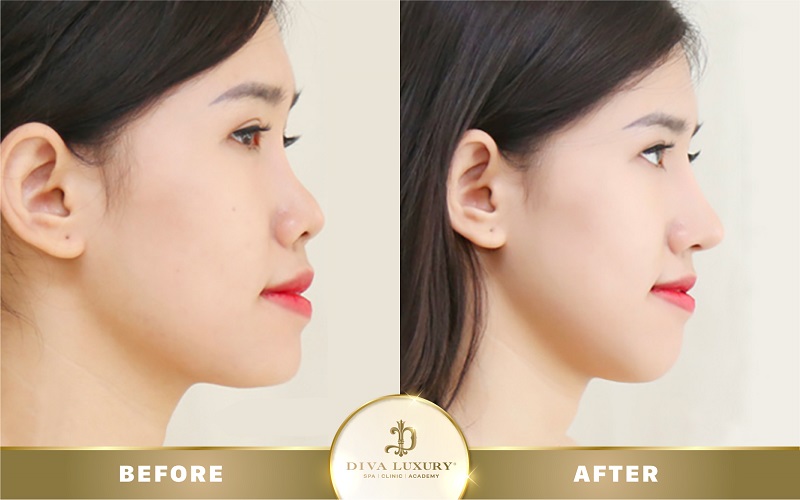 mo-goc-mat-o-dau-dep-6