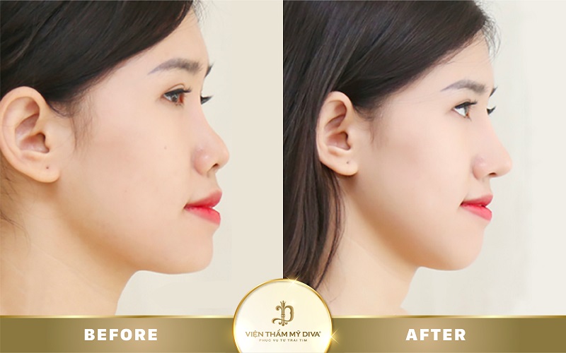 mo-goc-mat-o-can-tho mo-goc-mat-o-can-tho-5