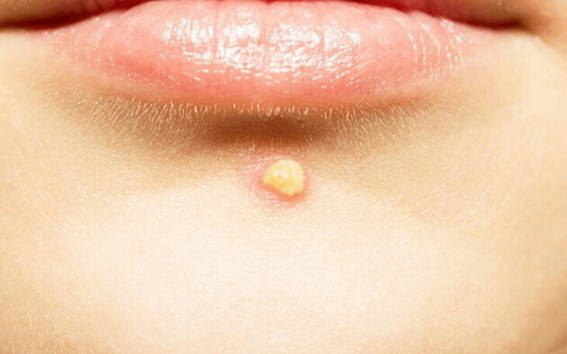 tri-mun-hoc-mon tri-mun-hoc-mon-4