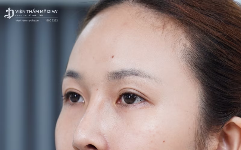 Lông mày thưa và ngắn ảnh hưởng nhiều đến thẩm mỹ của khuôn mặt