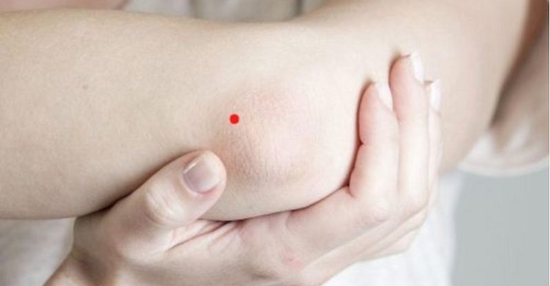 Nốt ruồi ở khuỷu tay có ý nghĩa gì? Tướng số Tốt hay xấu? 3