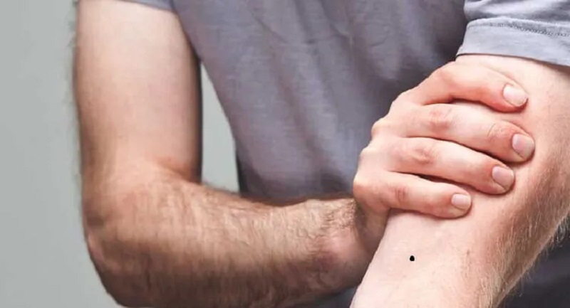 Nốt ruồi ở khuỷu tay có ý nghĩa gì? Tướng số Tốt hay xấu? 2
