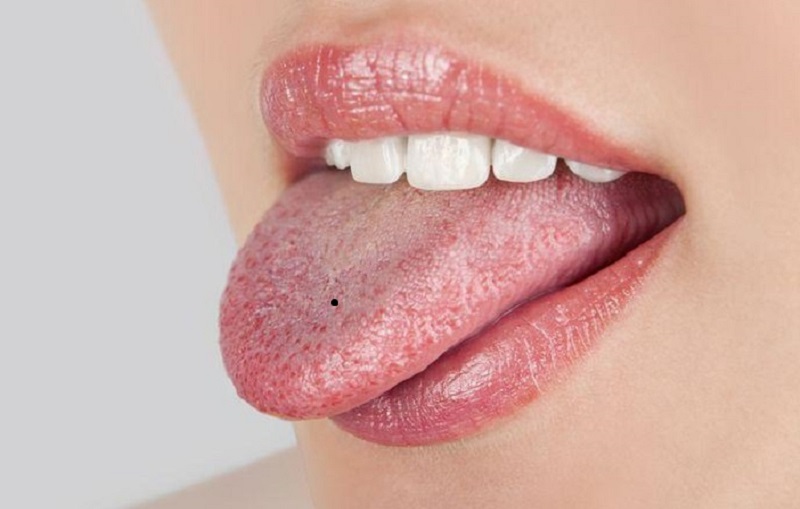 Thăm khám nốt ruồi 