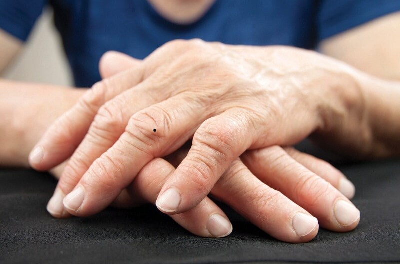 Tiết lộ Ý nghĩa Nốt ruồi Ngón Tay Áp Út: Tình Yêu, Sự Nghiệp và Tính Cách 2