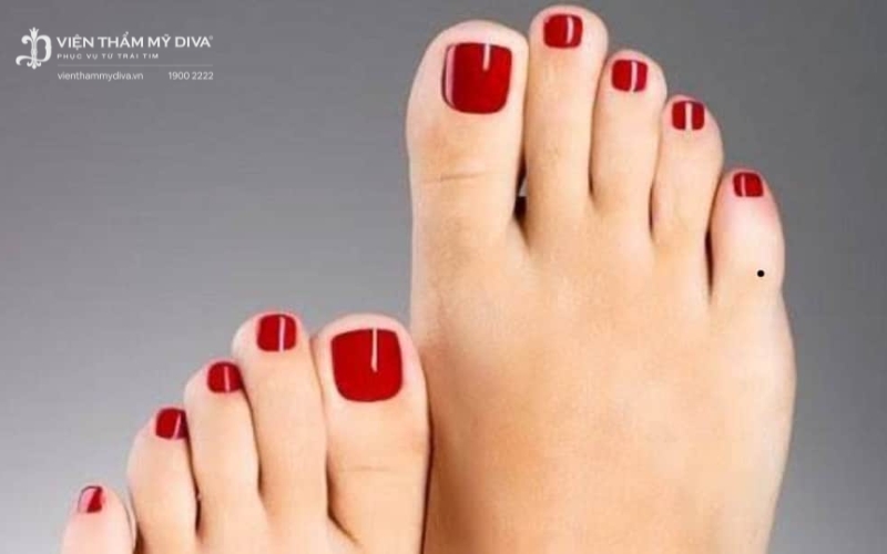 Nốt ruồi ở ngón chân út có ý nghĩa gì? Tướng số Tốt/ Xấu? 4 Nốt ruồi ở ngón chân út có ý nghĩa gì? Tướng số Tốt/ Xấu? 4