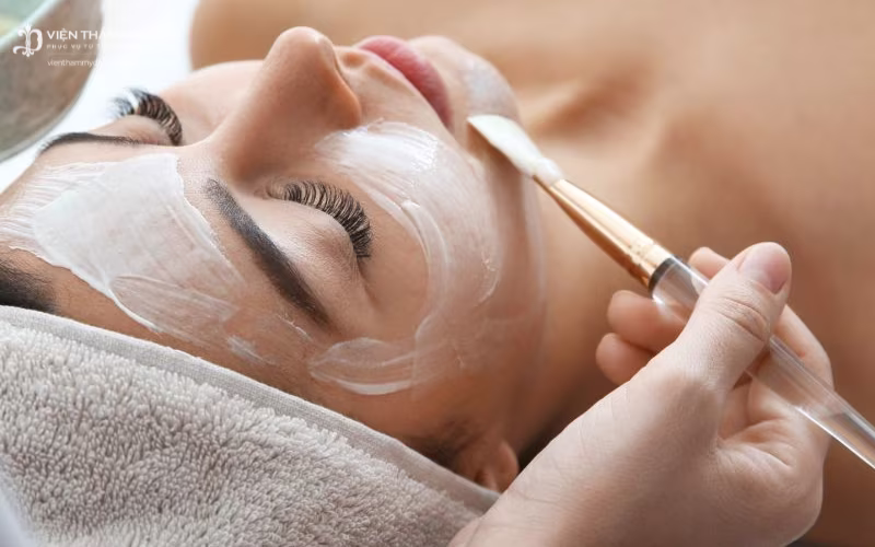Peel da điều trị sẹo rỗ giúp tái tạo cấu trúc da, là phẳng vết lõm bề mặt