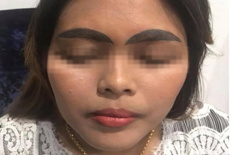 Tại sao không nên phun mày ở Rạch Giá "giá rẻ"?