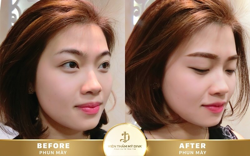 Viện thẩm mỹ DIVA