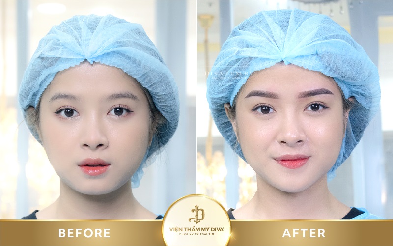 Hình ảnh trước - sau điều trị