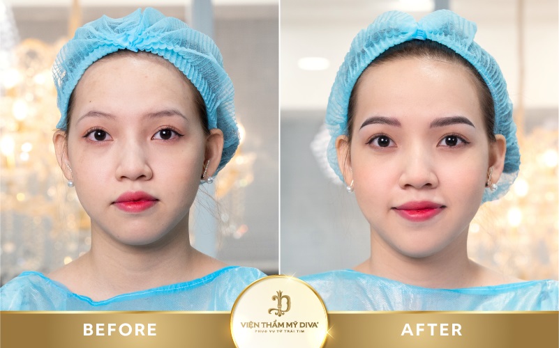 phun-may-tai-duc-trong-6