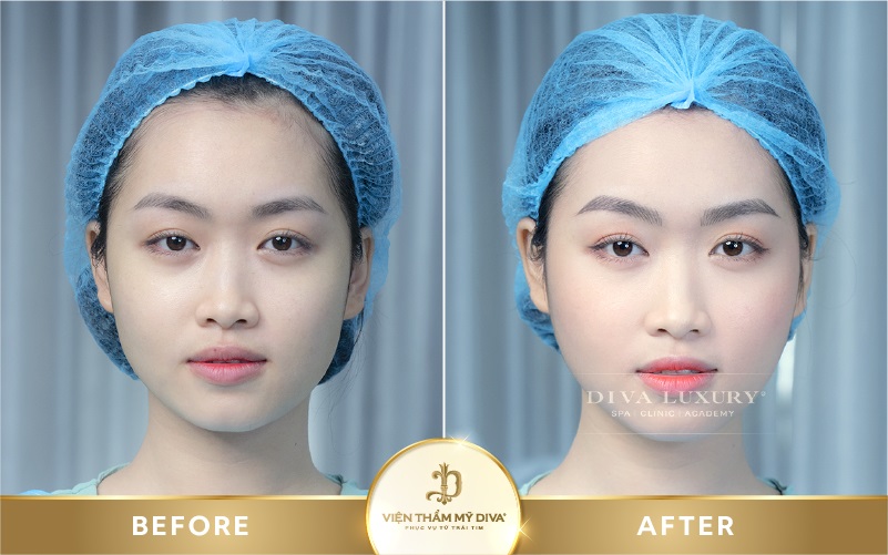 Viện thẩm mỹ DIVA