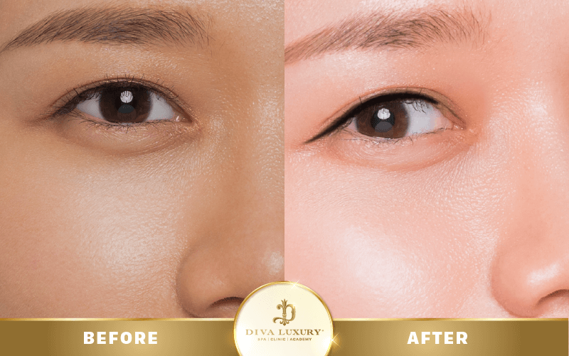 chuong-trinh-noel-vien-tham-my-diva chuong-trinh-noel-vien-tham-my-diva