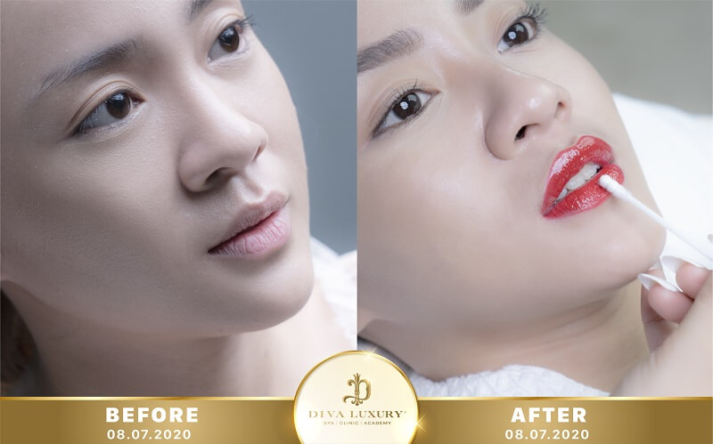 phun-moi-tai-binh-dinh phun-moi-tai-binh-dinh-6