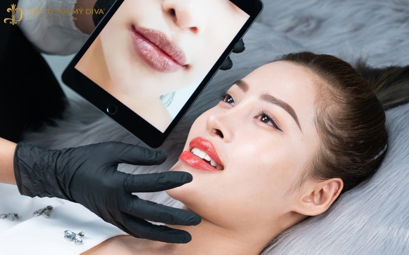 Phun Môi Tế Bào Gốc Bạc Liêu
