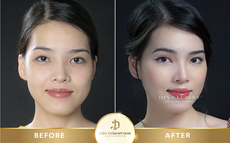 dam-moi-tai-duc-trong-10