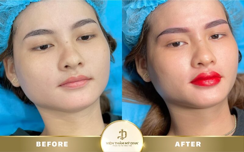 dam-moi-o-hong-ngu-9