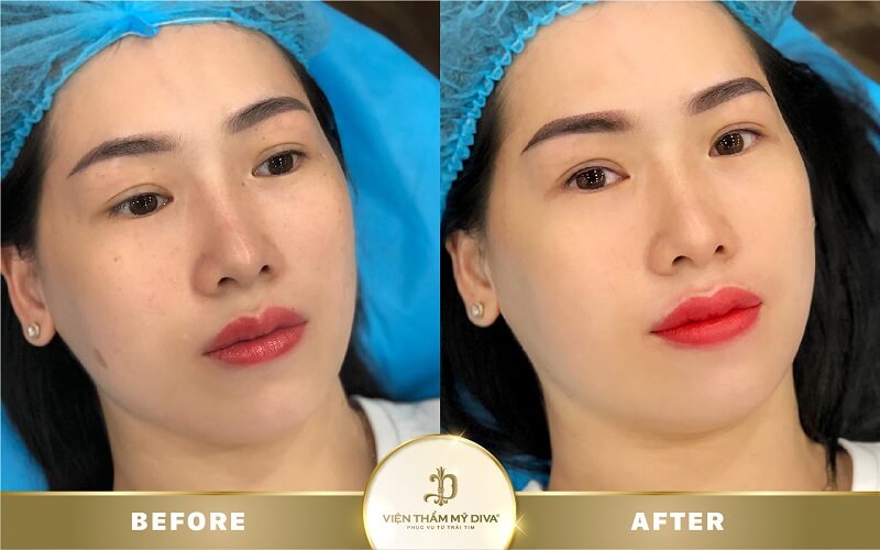 dam-moi-o-hong-ngu-8