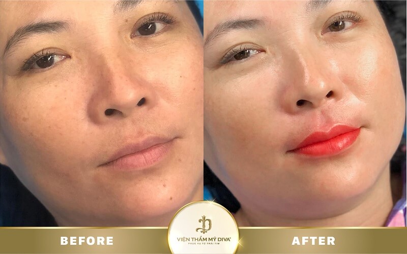 phun-moi-tai-duc-trong phun-moi-tai-duc-trong-12