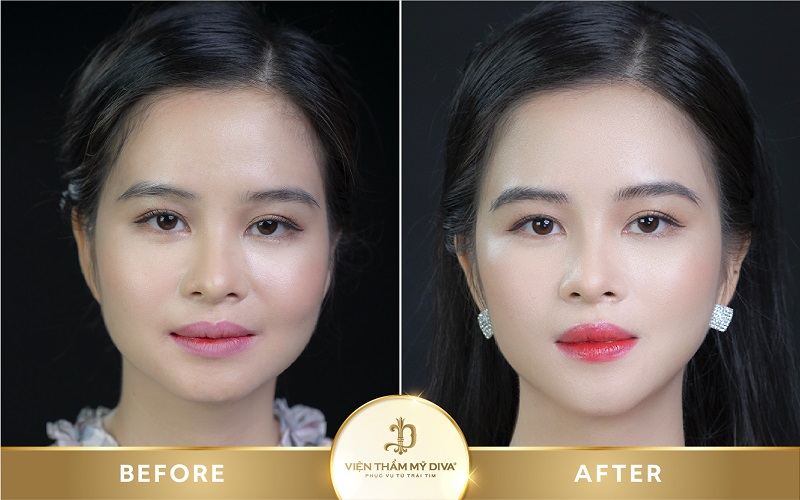 dặm môi ở bến cát