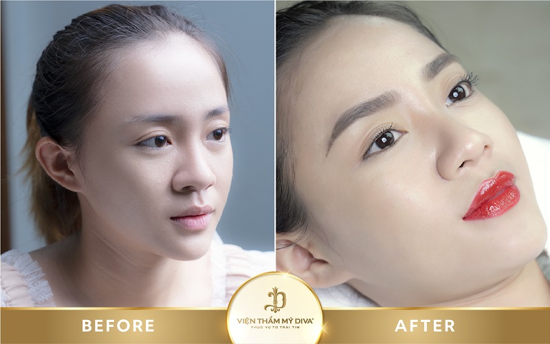 phun-moi-tai-duc-trong phun-moi-tai-duc-trong-6