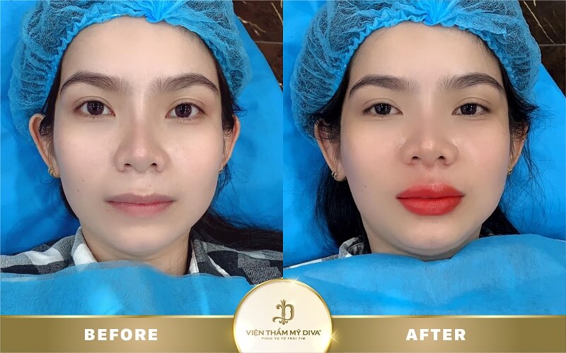 phun-moi-tai-duc-trong phun-moi-tai-duc-trong-11