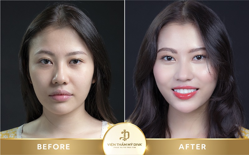dặm môi Bến Cát