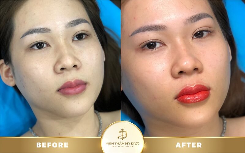 dam-moi-o-ninh-thuan-10