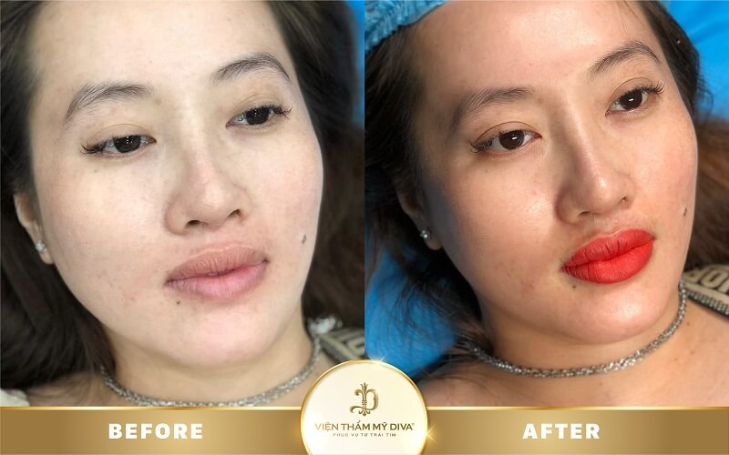 dam-moi-o-hong-ngu-4