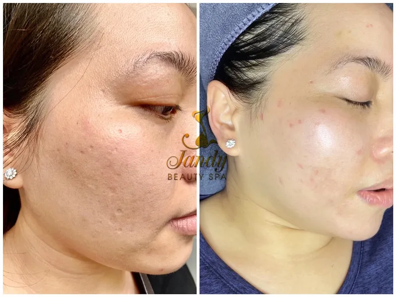 spa-uy-tin-o-quang-nam-jandy-beauty-spa