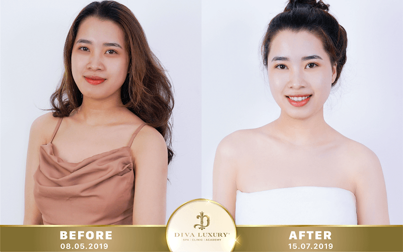 vien-tham-my-diva-quy-nhon-6