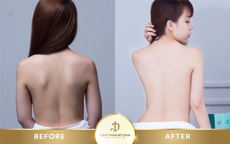 Hình ảnh trước - sau điều trị