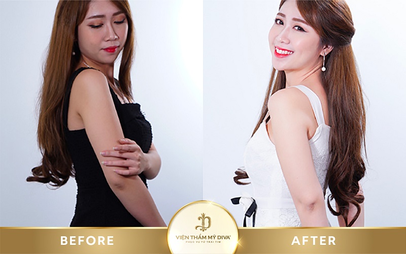 tắm trắng tại Viện thẩm mỹ DIVA