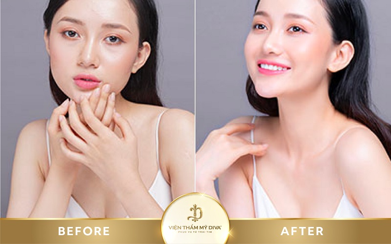 Viện thẩm mỹ DIVA