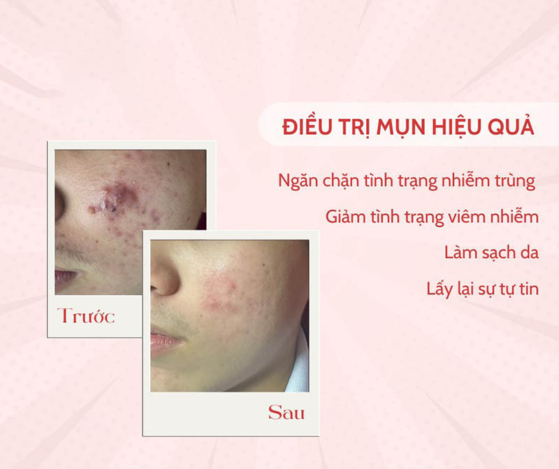 Thẩm mỹ Nguyên Thảo 