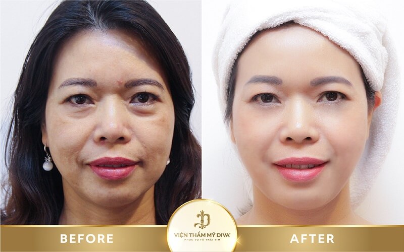 cang-da-mat-o-can-tho-8